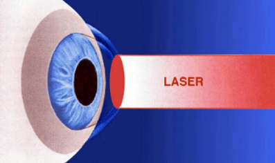 laser-excimer