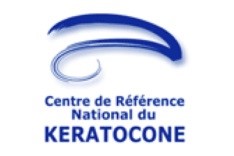 keratocone